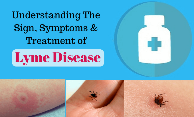 How to Recognize Lyme Disease: Early Symptoms and Effective Treatments